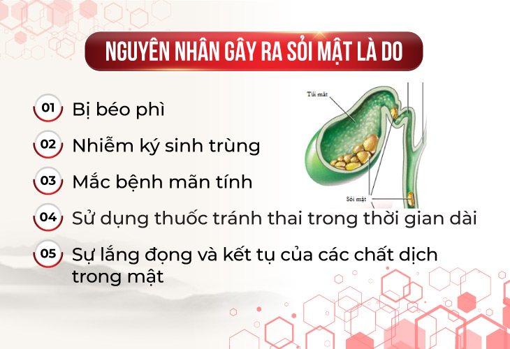 nguyên nhân gây ra sỏi mật 