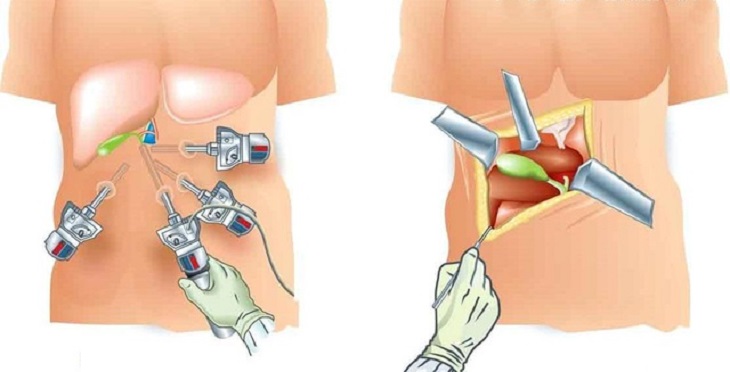 chức năng của túi mật 