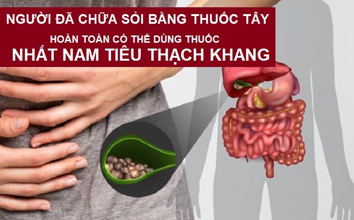 nhất nam tiêu thach khang chữa sỏi mật 