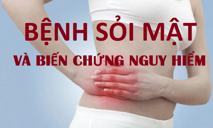 những biến chứng nguy hiểm của sỏi mật 